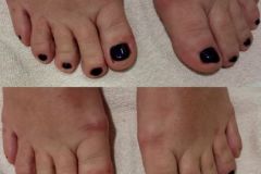 corfu-hair-salon-pedicure-22