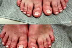 corfu-hair-salon-pedicure-29